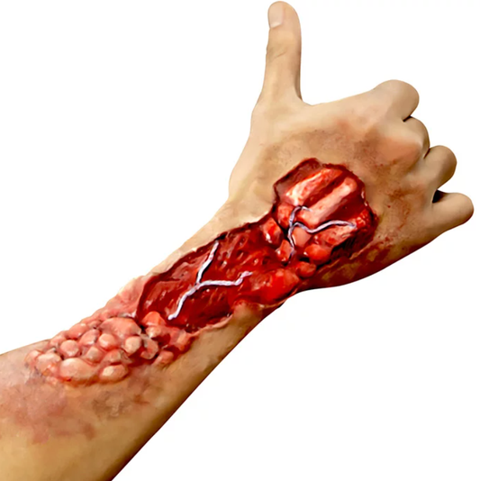 A man with the latex eaten away makeup prosthetic on his arm.
