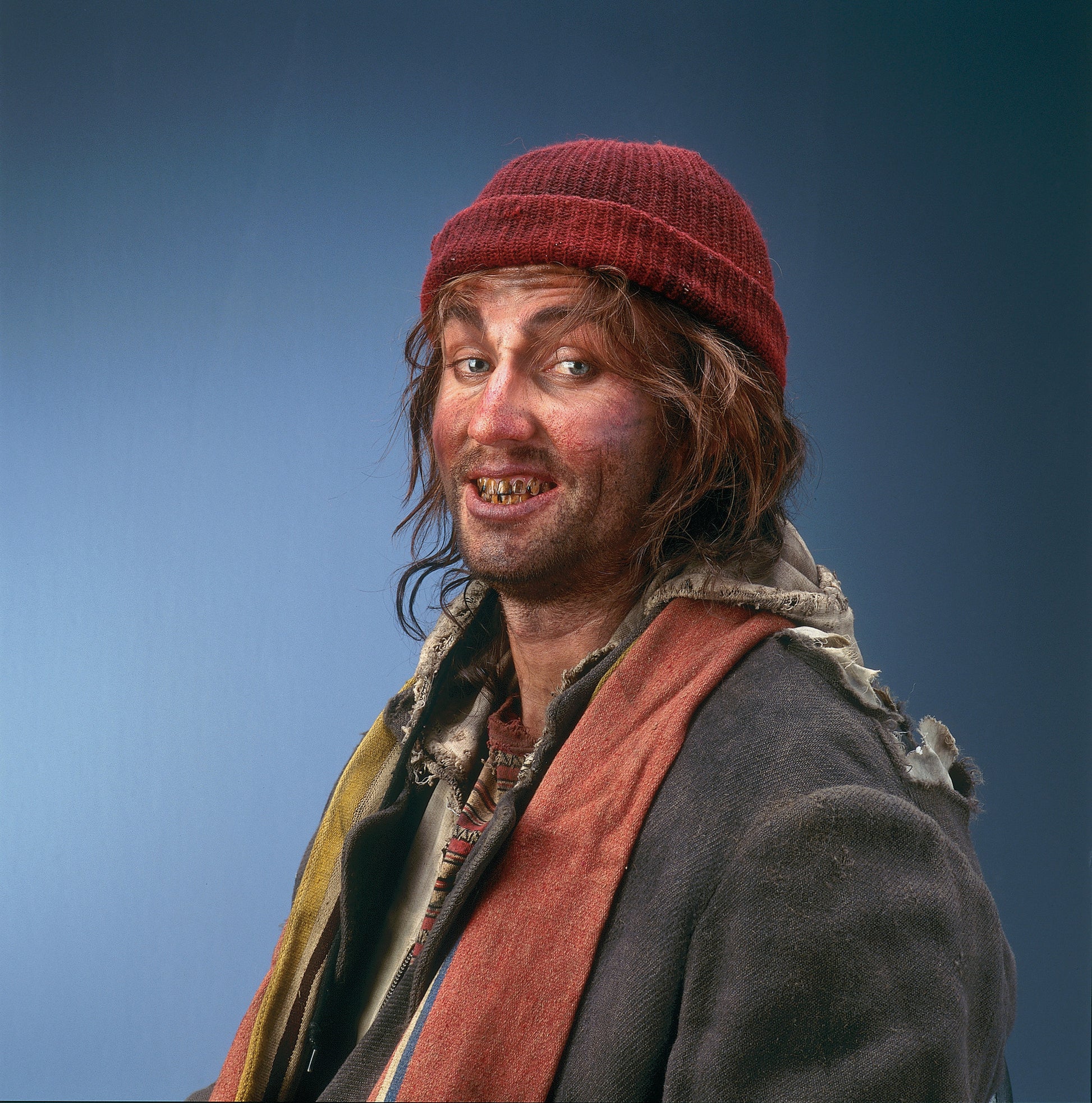 A man dressed up as a homeless make with dark yellow and brown tooth coloring in.